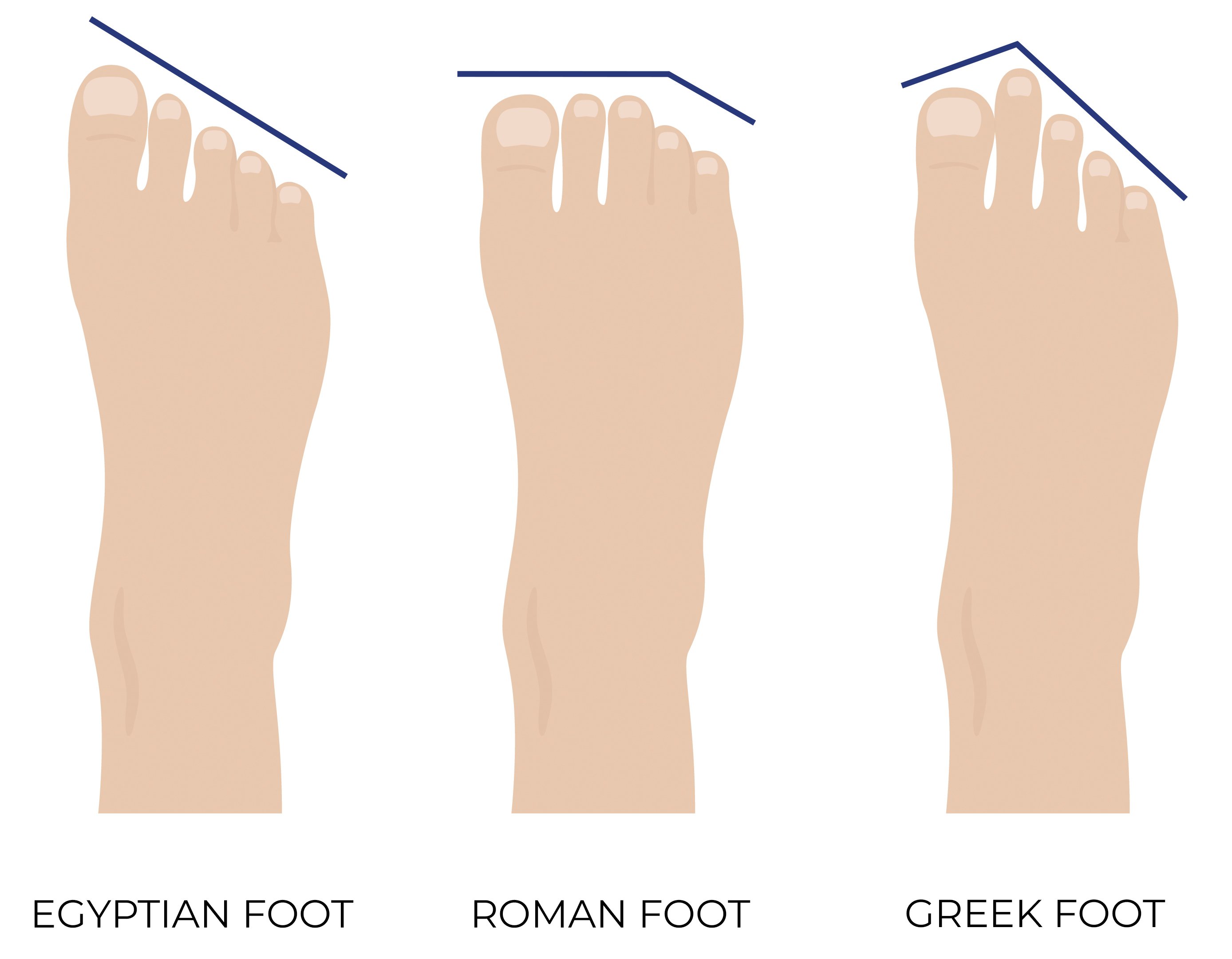 Understanding your foot shape for true comfort